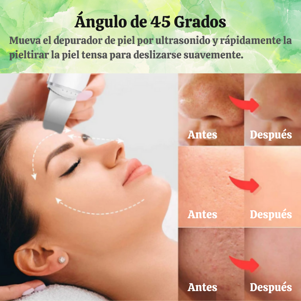 SkinWave Pro - Exfoliador Ultrasónico