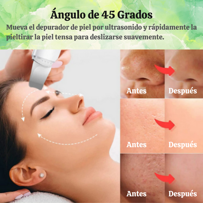 SkinWave Pro - Exfoliador Ultrasónico